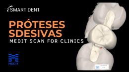 MEDIT Link: Próteses Adesivas - Planejamento Detalhado