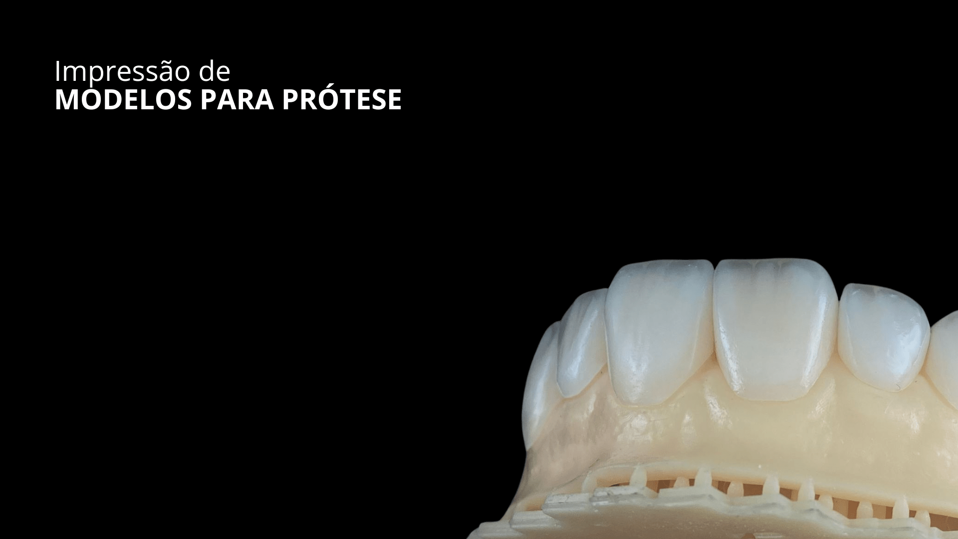 Impressão 3D: Otimize Modelos para prótese