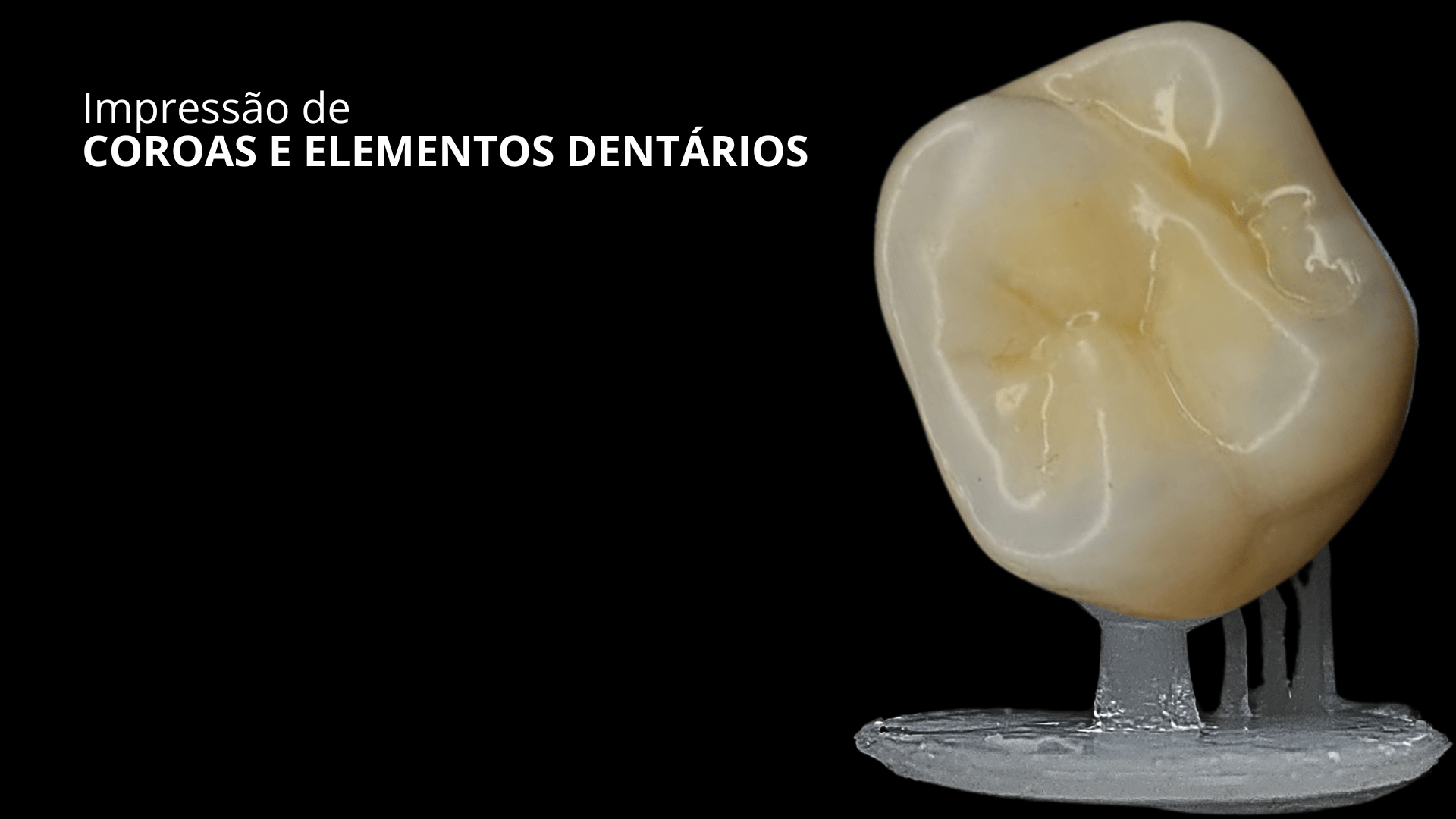 Impressão 3D de Coroas e Elementos Dentários