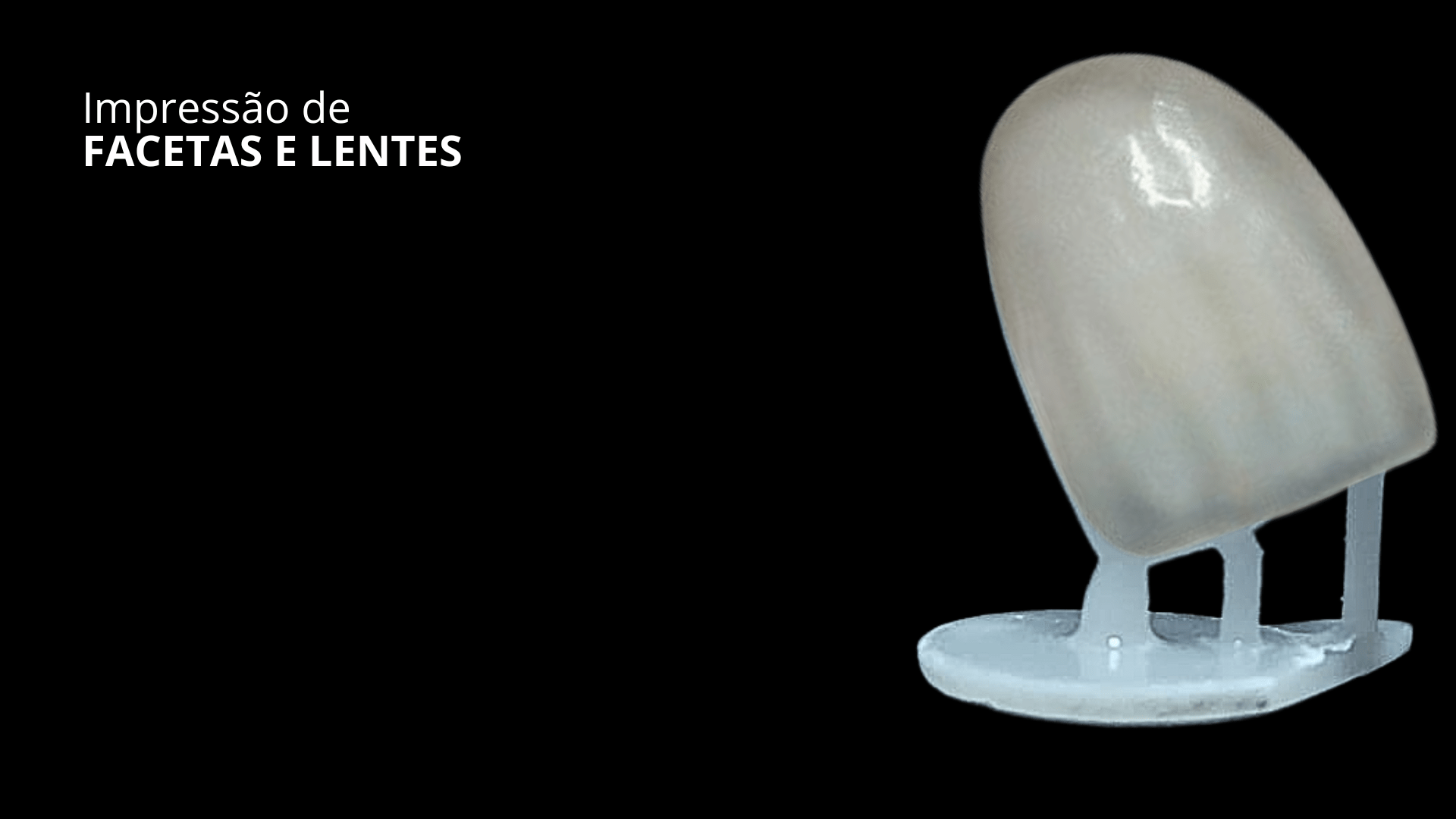 Impressão de Facetas e Lentes: Suporte Ideal para Precisão